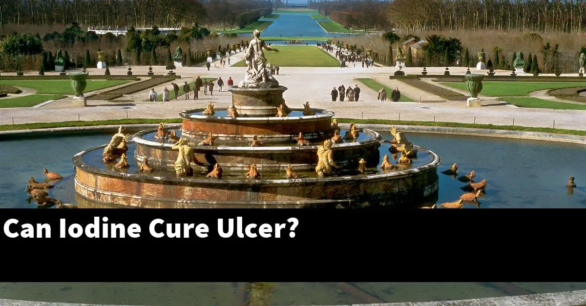 Can Iodine Cure Ulcer?