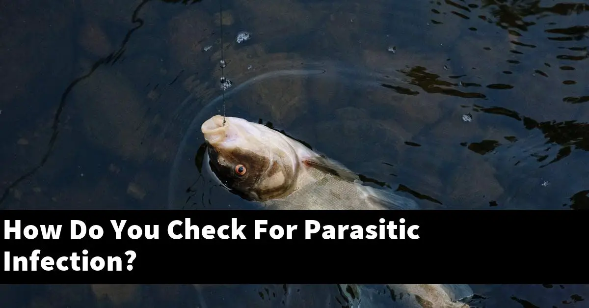How Do You Check For Parasitic Infection?