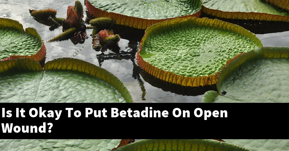 Is It Okay To Put Betadine On Open Wound?