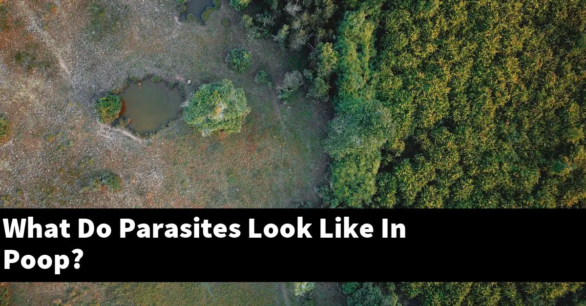 What Do Parasites Look Like In Poop?