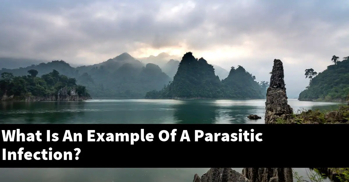 What Is An Example Of A Parasitic Infection?