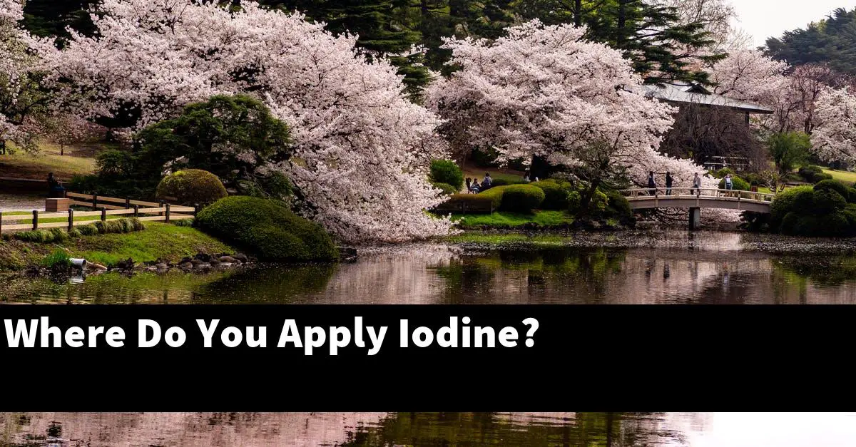 Where Do You Apply Iodine?
